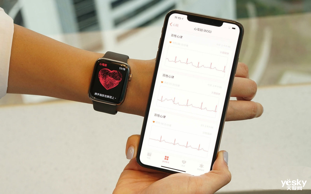 苹果更新watchos52港版applewatch支持心电图功能